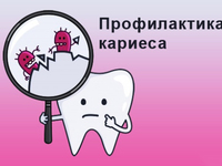 Профилактика кариеса - jcyjdyst vtnjls