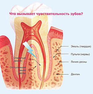 Как лечить гиперестезию