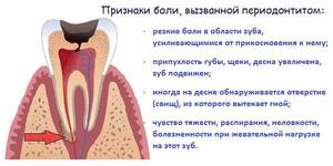 Переодонтит нижней челюсти