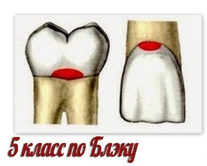 5 класс по Блэку