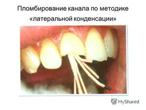 Сколько стоит лечение зубов