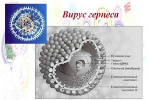 Вирус герпеса