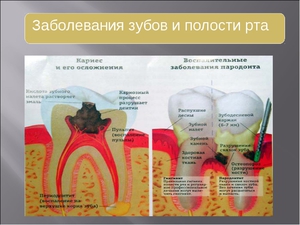 Лечение заболеваний полости рта