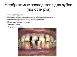Основные виды заболеваний полости рта