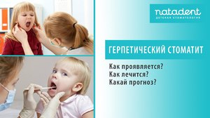 Проявление герпетического стоматита