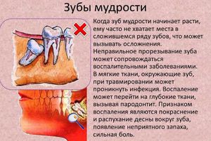 Когда растет зуб мудрости