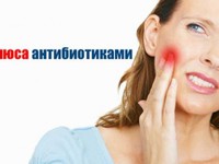 Общее описание флюса и его разновидности