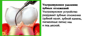 Биоинженерия будущего: выращивание зубов.