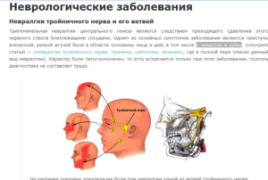 Какие симптомы невралгии