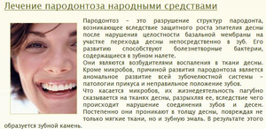 Какие методы лечения пародонтоза применть