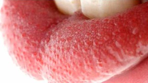 Описание вкусовых сосочков языка