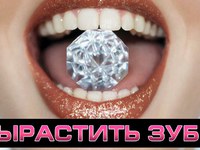 Способы выращивания зубов