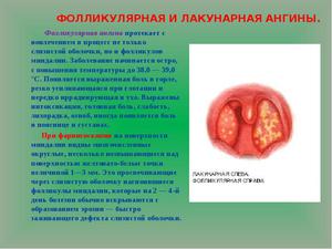 Какие существуют заболевания горла