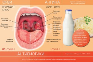 Болезни горла
