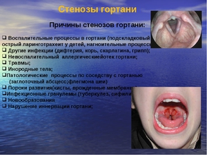 Какие меры предпринимать в целях профилактики