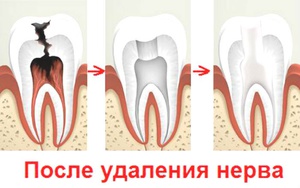 Избавления от боли