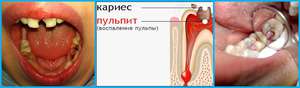Как народными способами унять боль