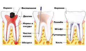 Способы унять зубную боль