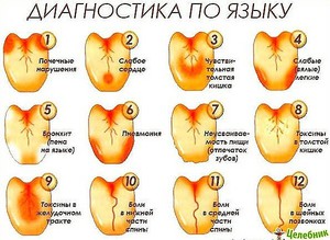 О чем говорит налет на языке