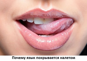 Возможные причины белого налета