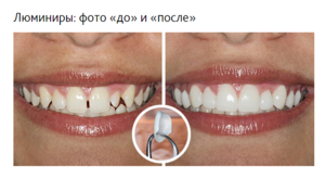 Люминиры
