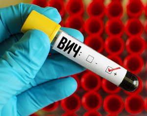 ВИЧ инфекция