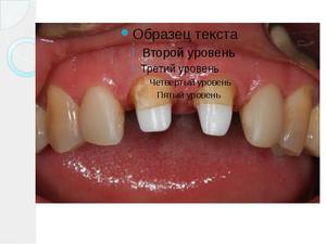 Изготовлени евкладок