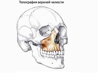 Верхняя челюсть