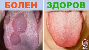 Чем лечат язык