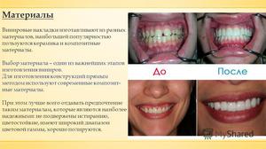 Применение композитных виниров