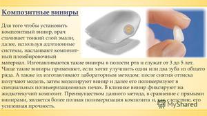 В чем преимущества виниров