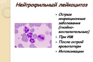 Форма лейкоцитоза