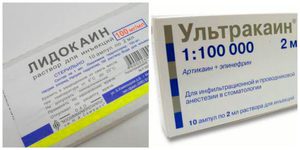 Как использовать ультракаин
